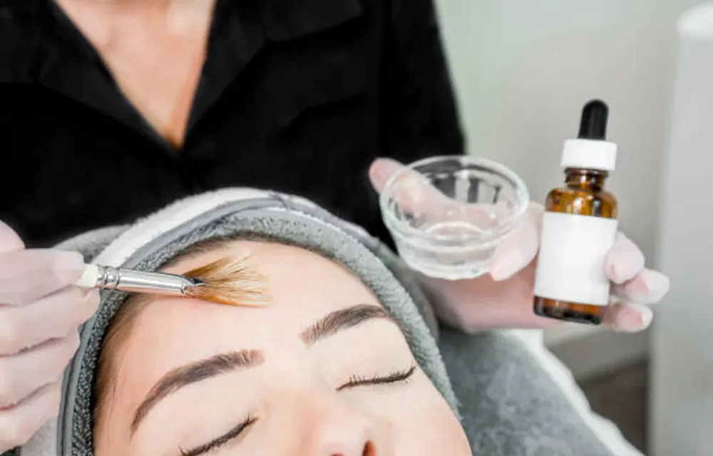 Aplicação de peeling químico no rosto