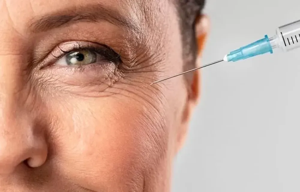 Aplicação de toxina botulínica na região dos olhos